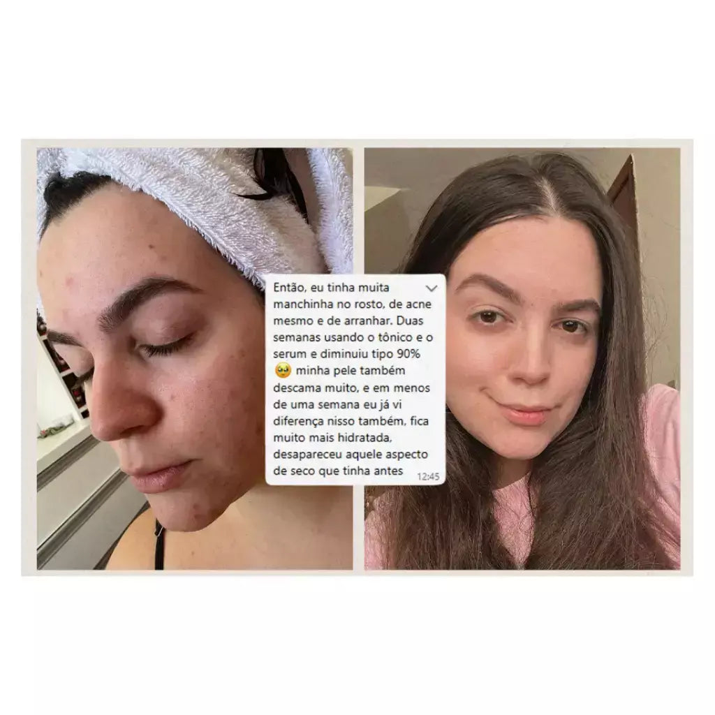 Sérum Facial e Área dos Olhos Vó Irene 30g