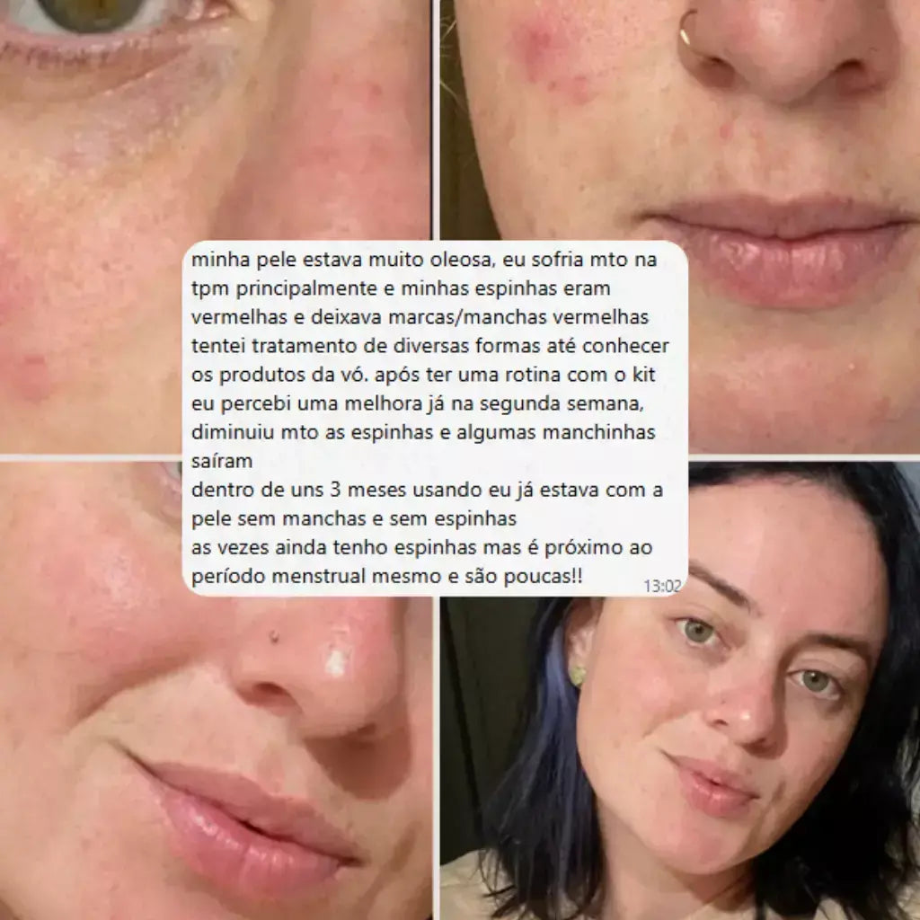 Sérum Facial e Área dos Olhos Vó Irene 30g