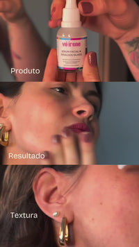 Vídeo 1